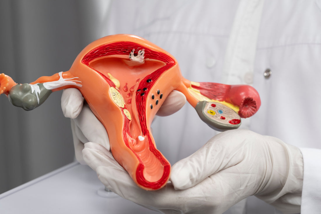 Understanding Ovarian Cysts: A Guide for Young Women